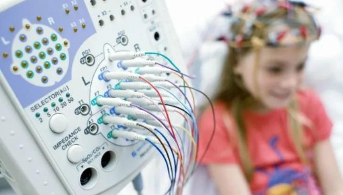 口碑力荐！武汉看癫痫好的医院在哪里-如何预防儿童癫痫病的发作？