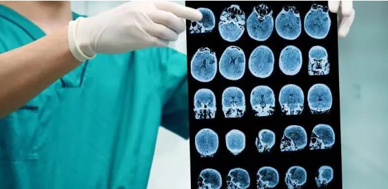 热搜榜单！宜昌治疗癫痫病口碑好医院排名-如何判断患者是否已经癫痫持续状态？