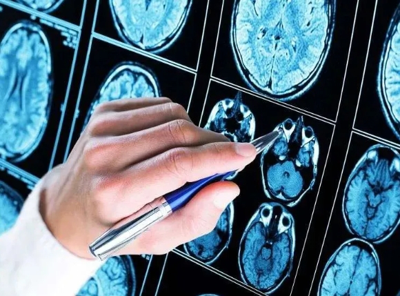 重磅消息！武汉哪家脑科医院医生治癫痫好-哪些因素容易诱发癫痫发作？