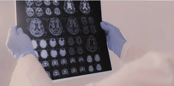 抗癫专科！武汉中际癫痫医院专业抗癫机构-怀孕了癫痫发作对宝宝有影响吗?