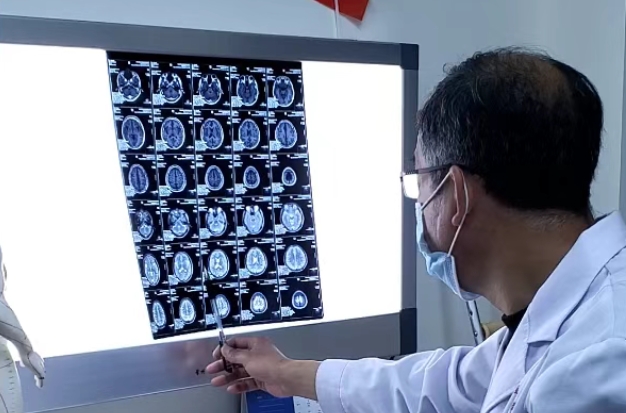 重磅消息！湖北看癫疯病好的医院是哪家-成年癫痫发病与脑部损伤的有关系吗？