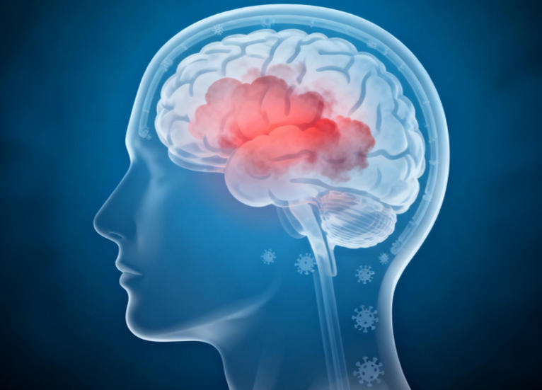 湖北哪家医院看癫疯病比较好-顶叶癫痫易被误判？这些典型症状要警惕！