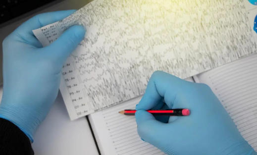 难治性癫痫患者注意！这些错误做法，会让发作更频繁