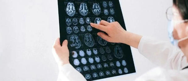 长辈患有癫痫，子女就一定会遗传发病吗？别过度焦虑